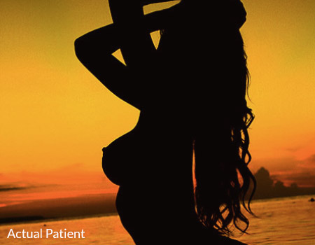 Breast Lift